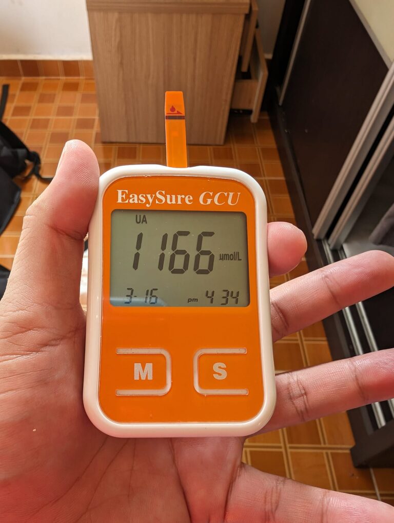 bacaan asid uric tinggi punca gout